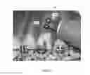 Fig. 04 - Device for electrical stimulation of peridontal complex and surrounding tissue