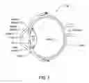 Fig. 02 - System for temporary nonpharmacologic constriction of the pupil