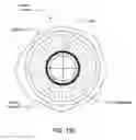 Fig. 26 - System for temporary nonpharmacologic constriction of the pupil