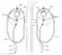 Fig. 01 - Methods and devices for neuromodulation of the adrenal gland