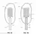 Fig. 06 - Methods and devices for neuromodulation of the adrenal gland