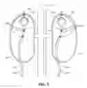 Fig. 07 - Methods and devices for neuromodulation of the adrenal gland