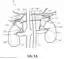 Fig. 09 - Methods and devices for neuromodulation of the adrenal gland