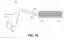 Fig. 10 - Methods and devices for neuromodulation of the adrenal gland
