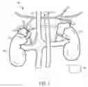 Fig. 12 - Methods and devices for neuromodulation of the adrenal gland
