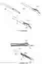 Fig. 09 - Apparatus and method for positioning, implanting and using a stimulation lead