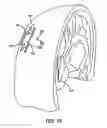 Fig. 10 - Aggregate electrode for neural stimulation