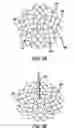 Fig. 12 - Aggregate electrode for neural stimulation