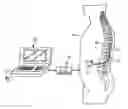 Fig. 01 - NEUROMODULATION SYSTEM AND METHOD FOR REDUCING ENERGY REQUIREMENTS USING FEEDBACK
