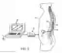 Fig. 04 - NEUROMODULATION SYSTEM AND METHOD FOR REDUCING ENERGY REQUIREMENTS USING FEEDBACK