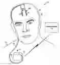 Fig. 01 - Therapeutic window determination