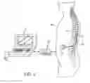 Fig. 03 - System and method for delivering modulated sub-threshold therapy to a patient