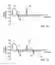 Fig. 09 - Method and system for cardiac pacing and defibrillation