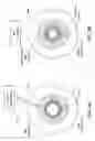 Fig. 05 - OPTICAL SYSTEM FOR NONPHARMACOLOGIC CONSTRICTION OF A PUPIL