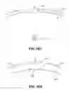 Fig. 16 - Energy based fat reduction