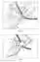 Fig. 04 - Ascender device and method of use