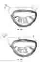 Fig. 12 - Golf club head with hosel support structure