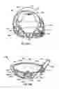 Fig. 30 - Golf club head