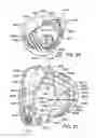 Fig. 45 - Golf club head