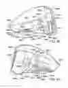 Fig. 46 - Golf club head