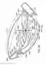 Fig. 48 - Golf club head