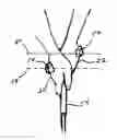 Fig. 01 - GOLF GRIP HAND STRUCTURE EFFICIENCY DEVICE AND METHOD OF USE