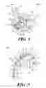 Fig. 02 - Adjustable billiards bridge device