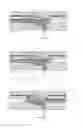 Fig. 02 - Filter system for viscous or highly viscous liquids, in particular plastic melts and method for filtering viscous or highly viscous liquids