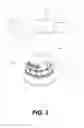 Fig. 06 - CREAM-TYPE COSMETIC CONTAINER COMPRISING VACUUM PUMP