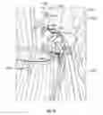 Fig. 20 - Apparatuses, systems, and methods for cleaning