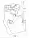 Fig. 02 - STAPLE GUN SYSTEM