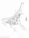 Fig. 05 - High capacity robot arm with adjustable joint at an end effector