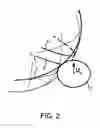 Fig. 03 - THREE-WHEEL DRIVE FOR SPHERICAL SURFACES