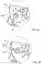 Fig. 05 - Multi-planar air diverter