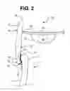 Fig. 03 - BEVERAGE TOPPER