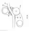 Fig. 07 - Bristled winch-guide