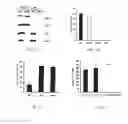 Fig. 02 - Methods of treating diabetes by an adipocyte protein 2 specific antibody