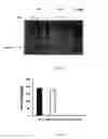 Fig. 07 - Methods of treating diabetes by an adipocyte protein 2 specific antibody