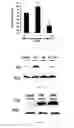 Fig. 09 - Methods of treating diabetes by an adipocyte protein 2 specific antibody