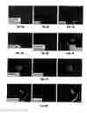 Fig. 07 - Anti-MCAM antibodies and associated methods of use