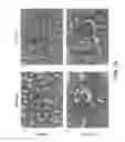 Fig. 33 - METHODS FOR REDUCING PROTEINURIA IN A HUMAN SUBJECT SUFFERING FROM IMMUNOGLOBULIN A NEPHROPATHY