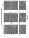 Fig. 46 - METHODS FOR REDUCING PROTEINURIA IN A HUMAN SUBJECT SUFFERING FROM IMMUNOGLOBULIN A NEPHROPATHY