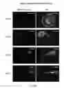 Fig. 65 - Targeted RNA knockdown and knockout by type III-A Csm complexes