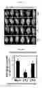 Fig. 09 - Method for producing lysophosphatidylethanolamine 18:1 from microorganism of sp