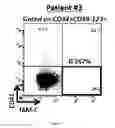 Fig. 04 - NEW BIOMARKER FOR OUTCOME IN AML