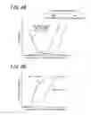 Fig. 06 - CONTINUOUS HOT-DIP METAL COATING METHOD AND CONTINUOUS HOT-DIP METAL COATING LINE