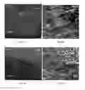 Fig. 11 - METAL DEPOSITS, COMPOSITIONS, AND METHODS FOR MAKING THE SAME