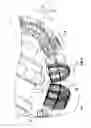 Fig. 09 - Roller cone drill bit with evenly loaded cutting elements