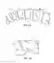 Fig. 04 - Clutch plate separation for drag loss reduction