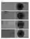 Fig. 06 - METHOD FOR PICKING A COLONY OF CELLS